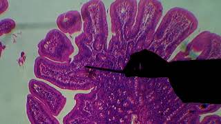 Histologia do Intestino Delgado [upl. by Viglione]