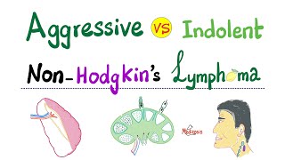 Hodgkin’s Lymphoma vs NonHodgkins Lymphoma  Comparison  Hematology and Oncology [upl. by Martres]