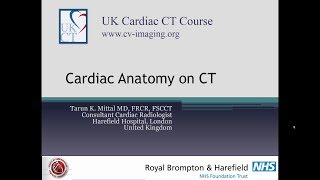 Cardiac anatomy on CT  Part A [upl. by Tohcnarf808]