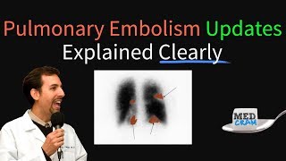 Understanding and Diagnosing Venous Thromboembolism VTE [upl. by Rudolfo]