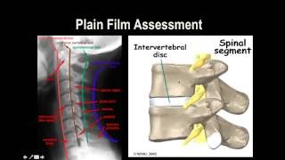 Cervical Spine XRay [upl. by Rizzo]