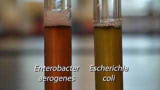 Demo Biochemical Tests  Voges Proskauer Test [upl. by Moyer]