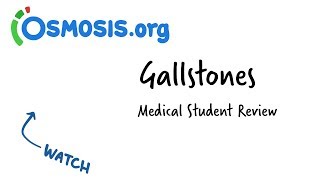 Gallstones  Clinical Presentation [upl. by Eislrahc]