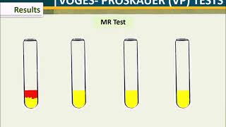 MRVP Test [upl. by Medora667]