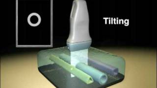 Ultrasound Transducer Manipulation [upl. by Socram]