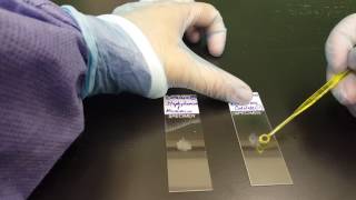 Microbiology the Catalase test [upl. by Vinaya]