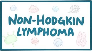 NonHodgkins Lymphoma  Aggressive type VS Indolent type  Hematology and Oncology [upl. by Coplin]