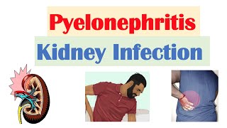 Pyelonephritis Kidney Infection  Causes Pathophysiology Signs amp Symptoms Diagnosis Treatment [upl. by Alurd]