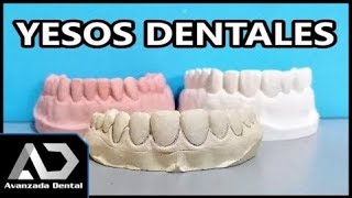 Tipos De Yeso Dentales Odontología miniClase [upl. by Llertnod]