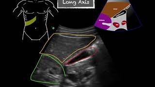 POCUS  Gallbladder Ultrasound Anatomy [upl. by Ielhsa]