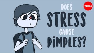 How to Manage Stress as a Student [upl. by Nahtanohj]