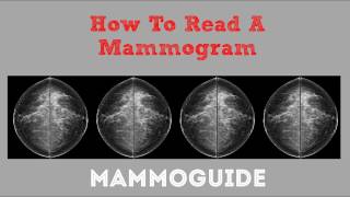 How To Read A Mammogram [upl. by Nibroc]