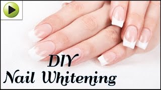 How to Whiten Your Nails Naturally [upl. by Caye]