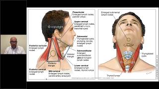 Neck lumps in general practice [upl. by Bolling]